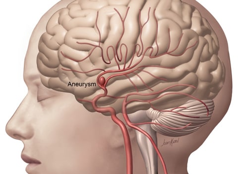 Neurosurgeon in Aurangabad